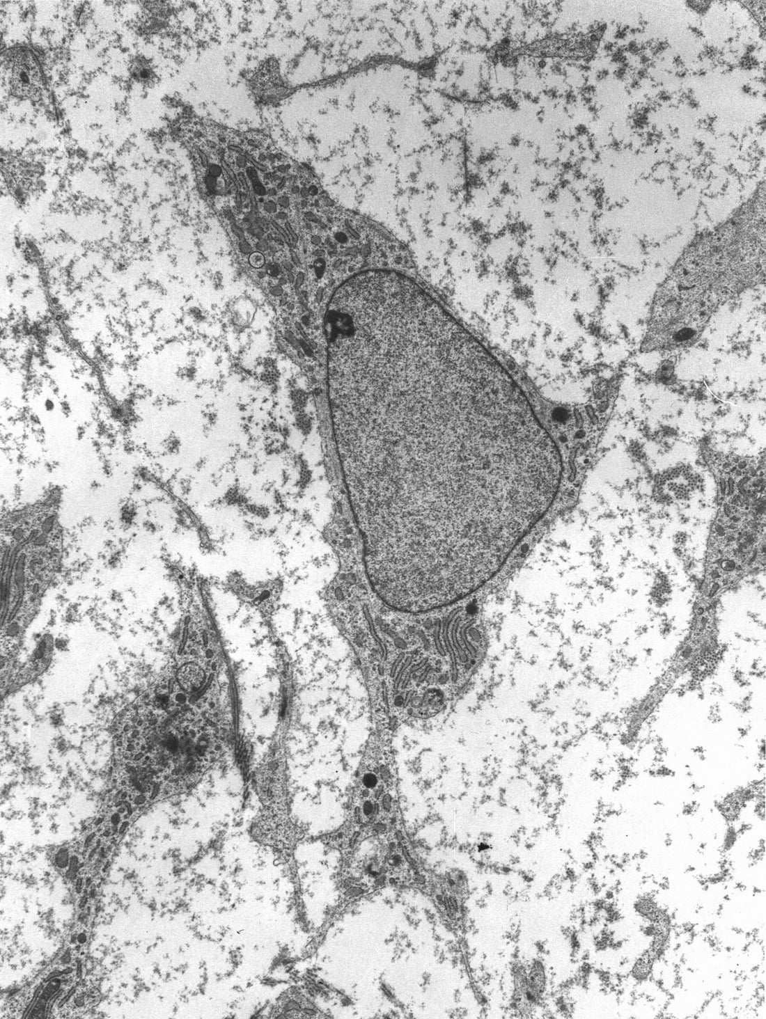 Hallmarks of aging: stem cell exhaustion
