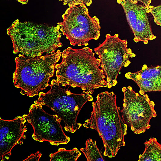 Novel cancer halt method boosts longevity