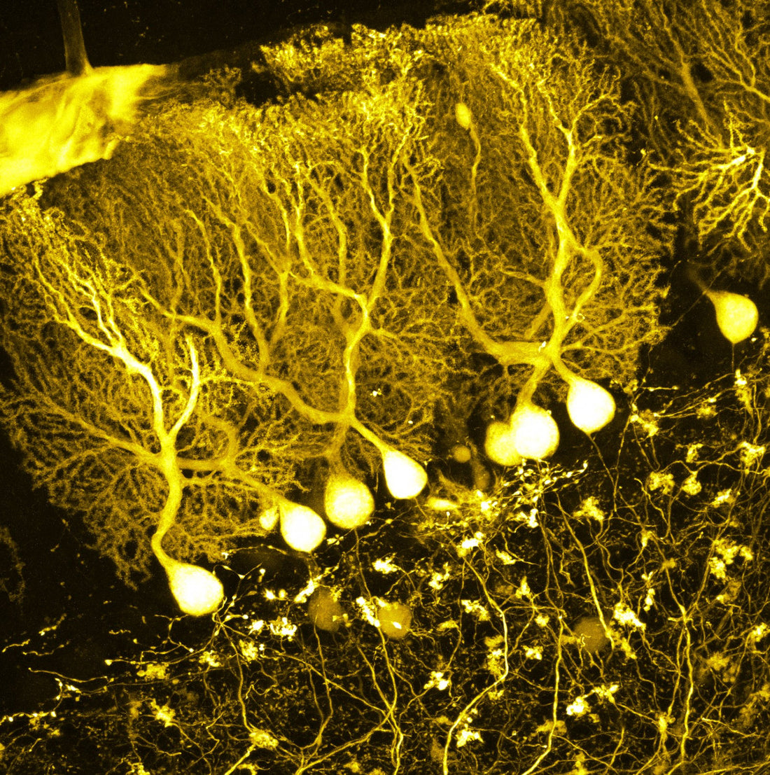 Hallmarks of aging: cellular senescence