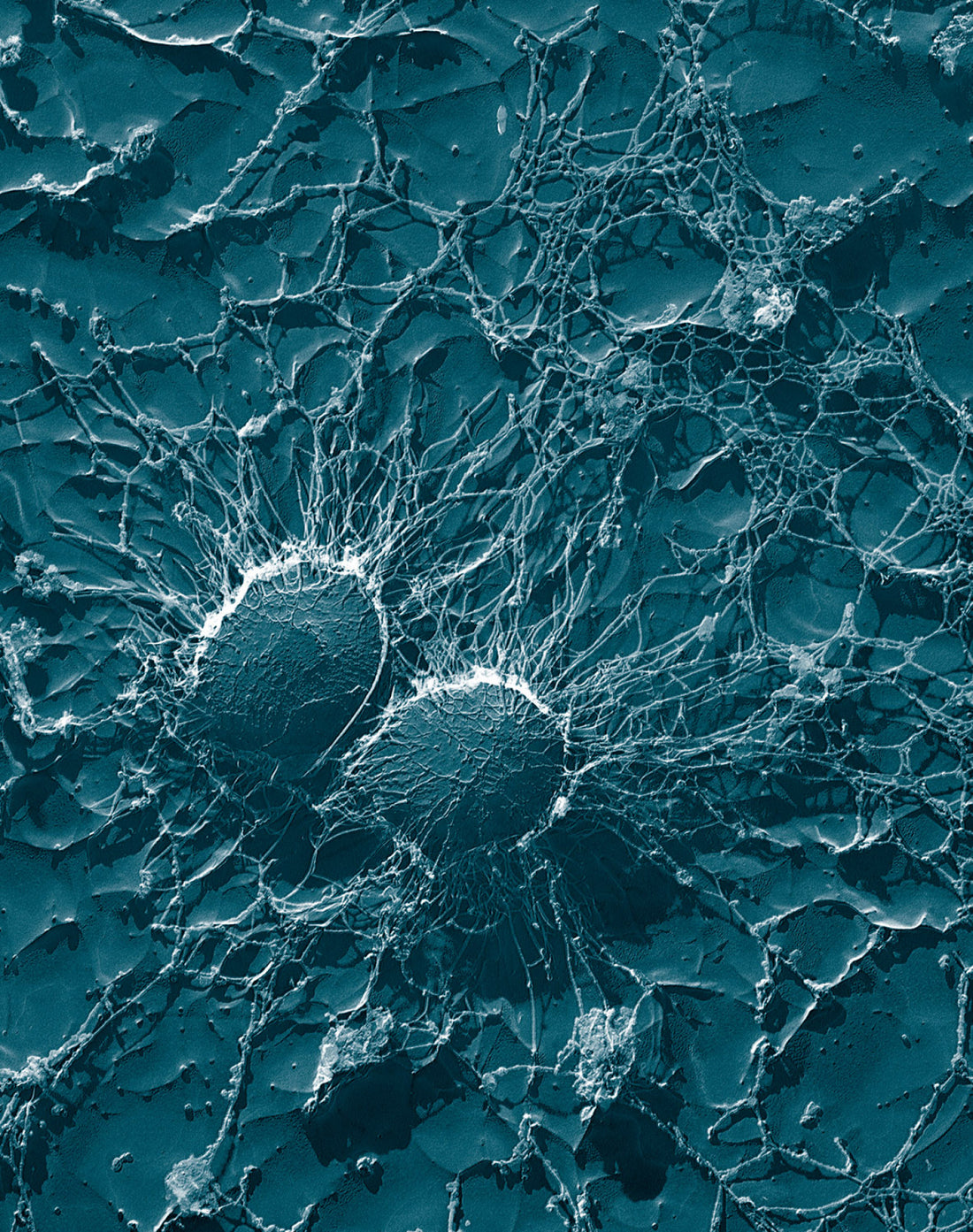 Hallmarks of aging: dysbiosis