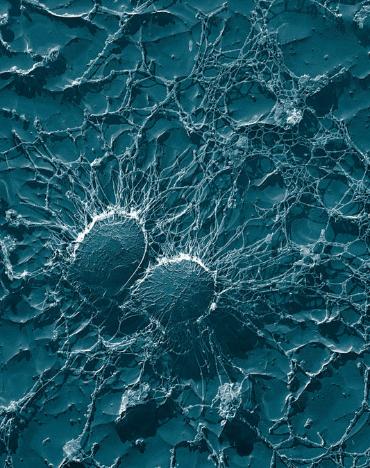 Hallmarks of aging: dysbiosis