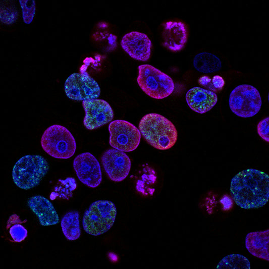 Revolutionary urine test reveals aging process insights